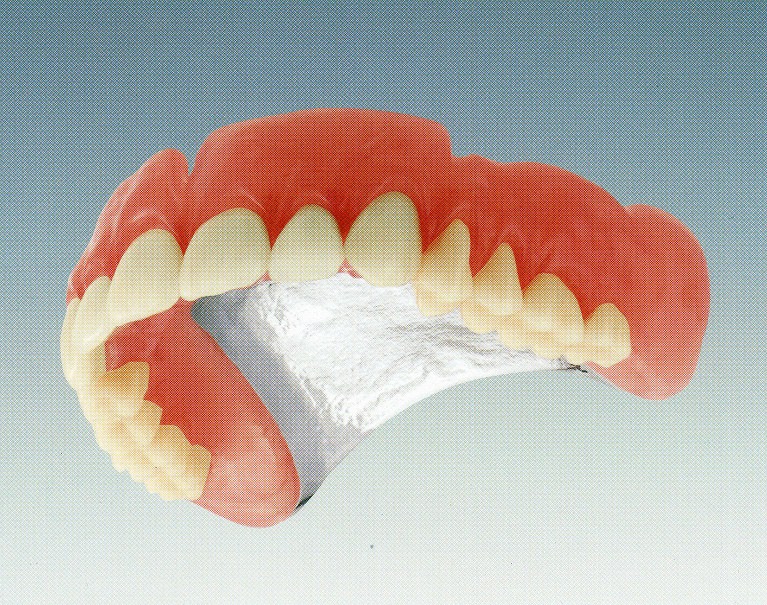 タイコニウム床義歯