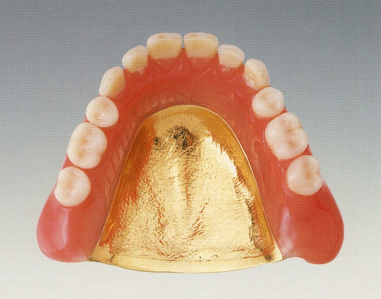 金・プラチナ床義歯
